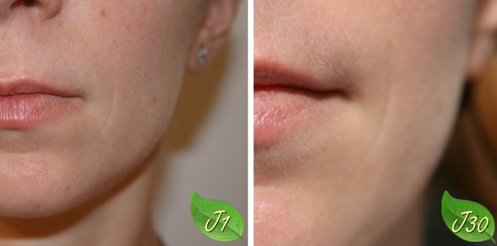 choupnbeauty_premières_rides